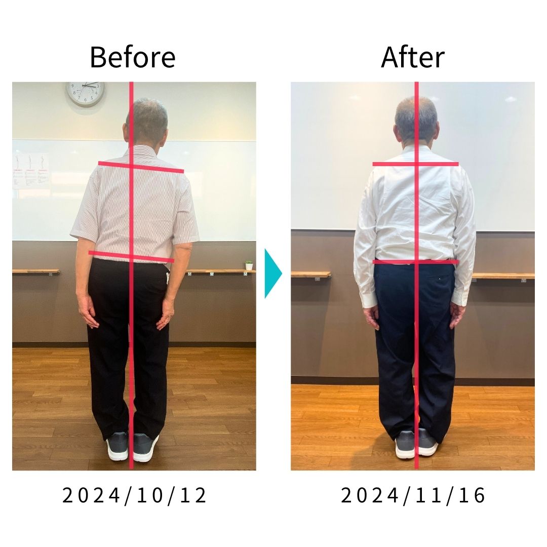 Before After 比較写真