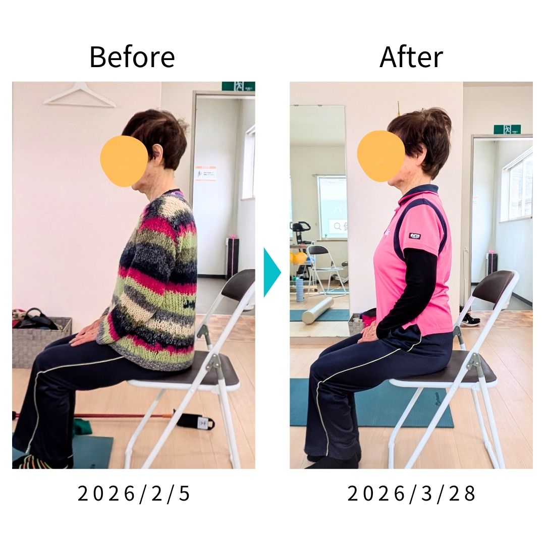 Before After 比較写真